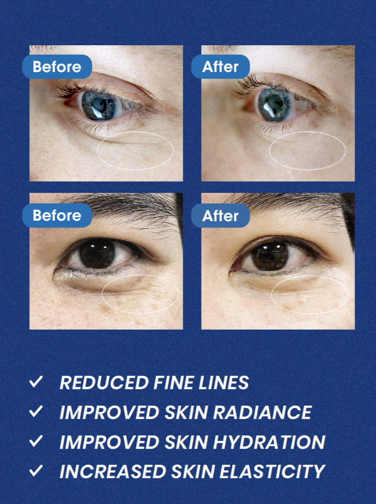 Illumin-eyes Micro HA Filler Mask - Infracyte