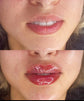 Intensive Lip Care Kit - Infracyte